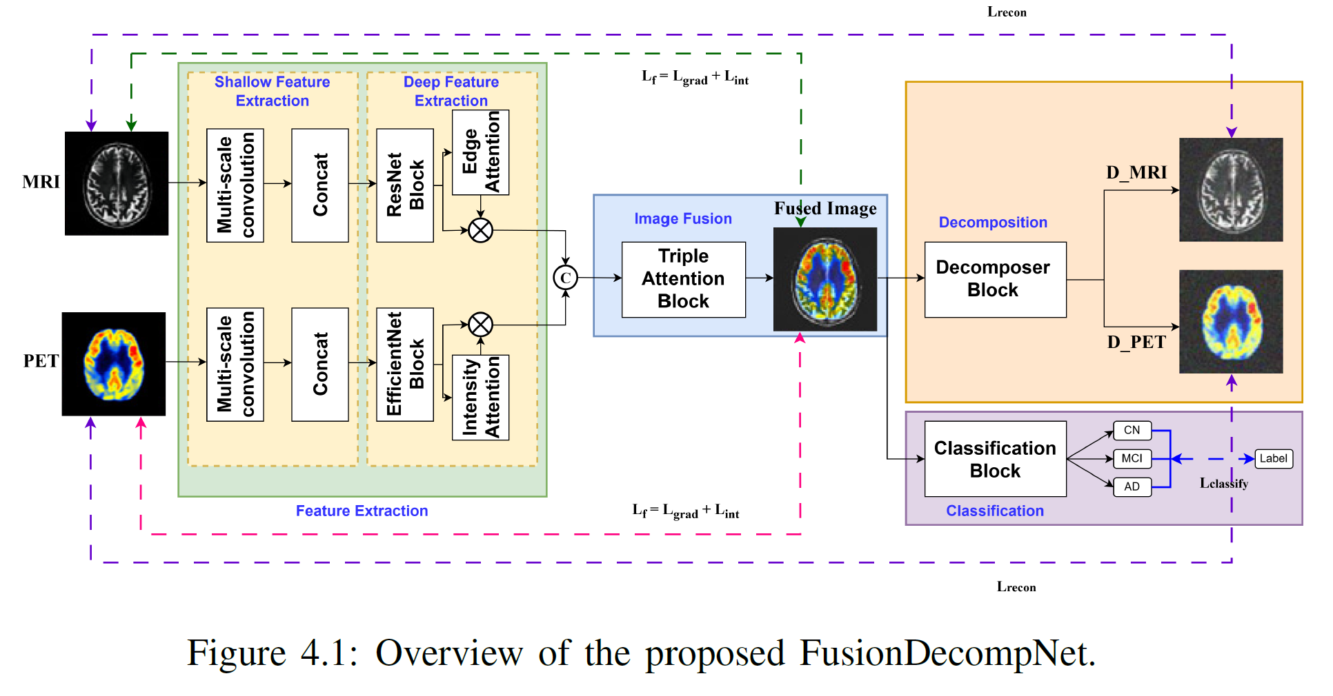 FusionDecompNet: A Multimodal Multitask Learning Framework for Alzheimer’s Diagnosis