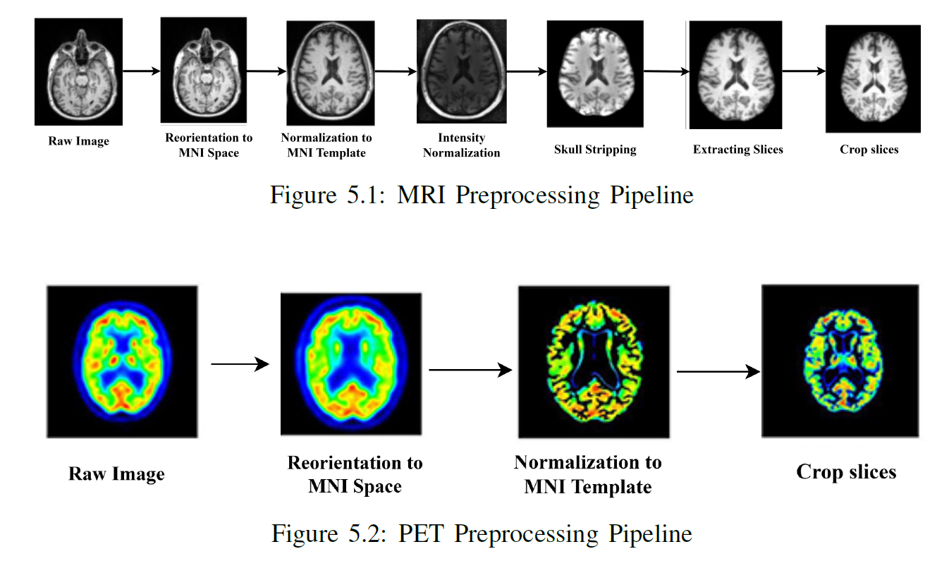 MRI and PET Preprocessing Pipeline