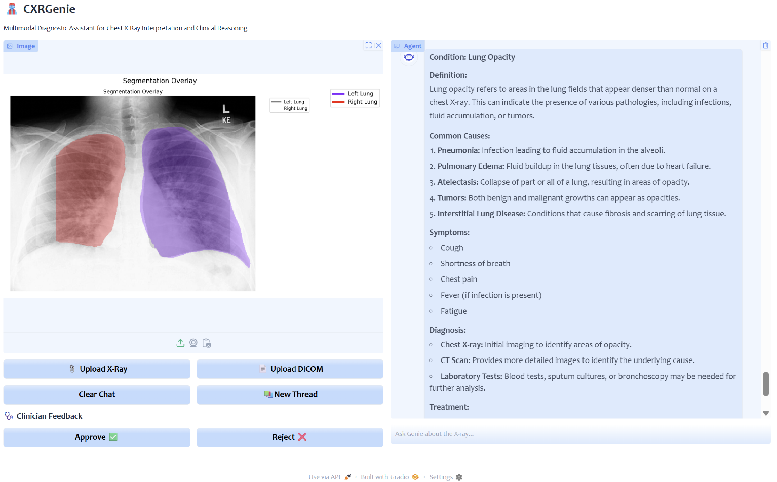 Chest X-ray Diagnostic Assistant