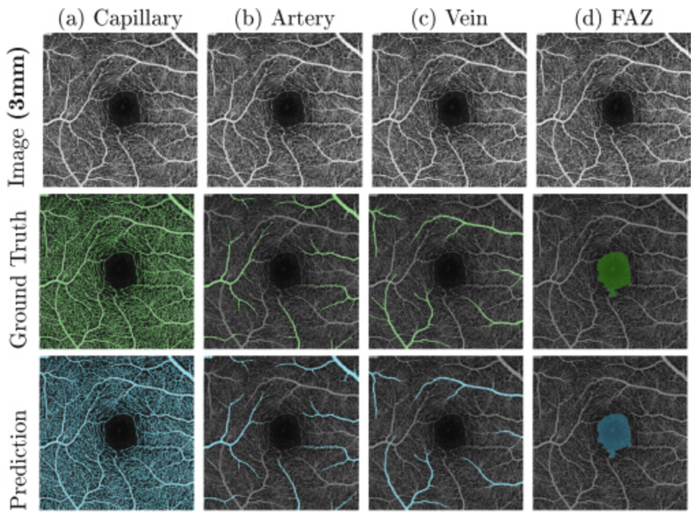Spatially Enhanced U-Net with Non-Local Attention Gates for Automated Retinal Vasculature and Foveal Avascular Zone Segmentation in OCTA Images