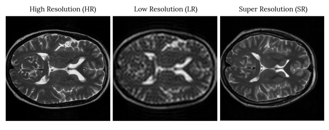 Z-axis Super Resolution